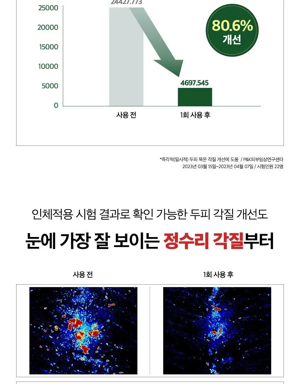 [대용량] CKD 아미노 비오틴 두피 각질 샴푸 750ml 상세페이지 11